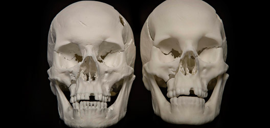 Richard III replica skulls