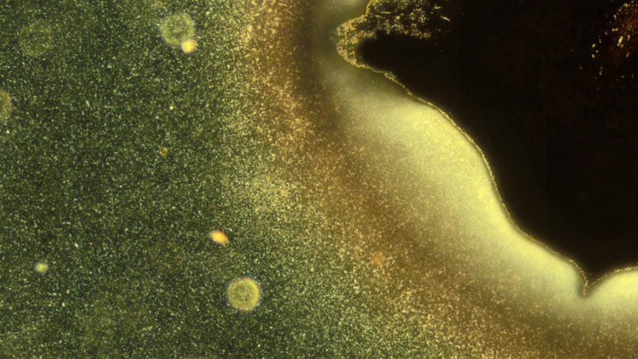 Figure caption: Most microorganisms do not float individually in water but live together in organised communities called biofilms. In this microscopy image, some bacteria (bright particles) are shown as they take the first steps in the formation of a biofilm. Image credits: G. Schkolnik & M. G. Mazza.