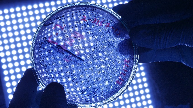 a plate of bacteria being held by two gloved hands