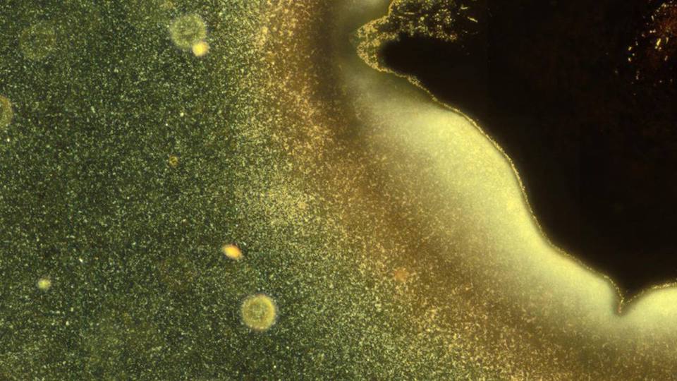 Microscopy image, some bacteria (bright particles) are shown as they take the first steps in the formation of a biofilm.