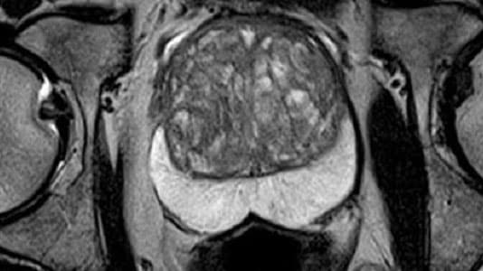 An MRI scan