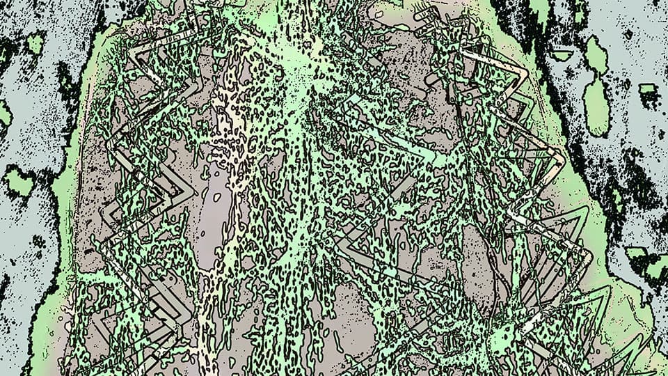 Gary Barker, Spinal Pain 2