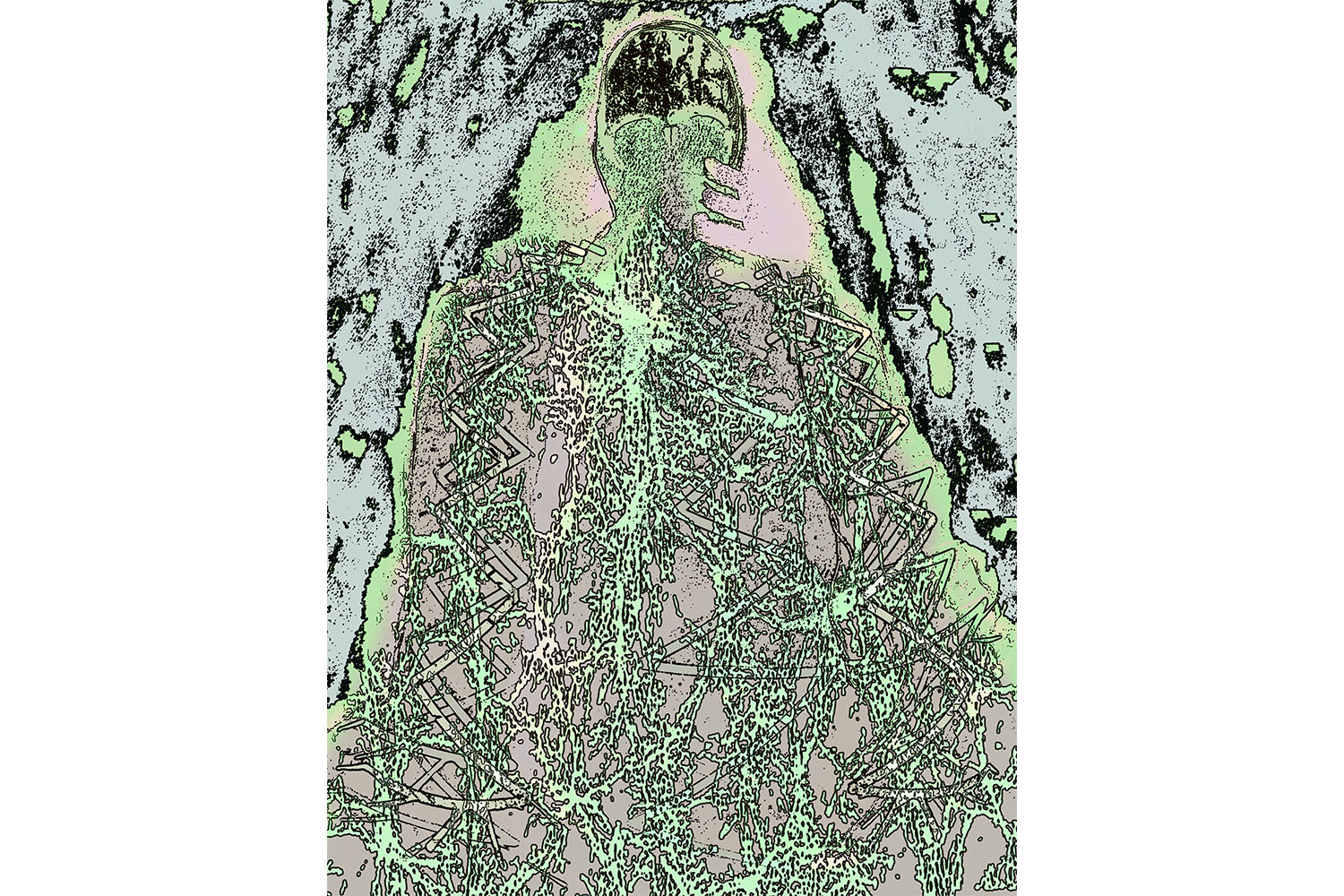 Garry Barker, Spinal Pain 2