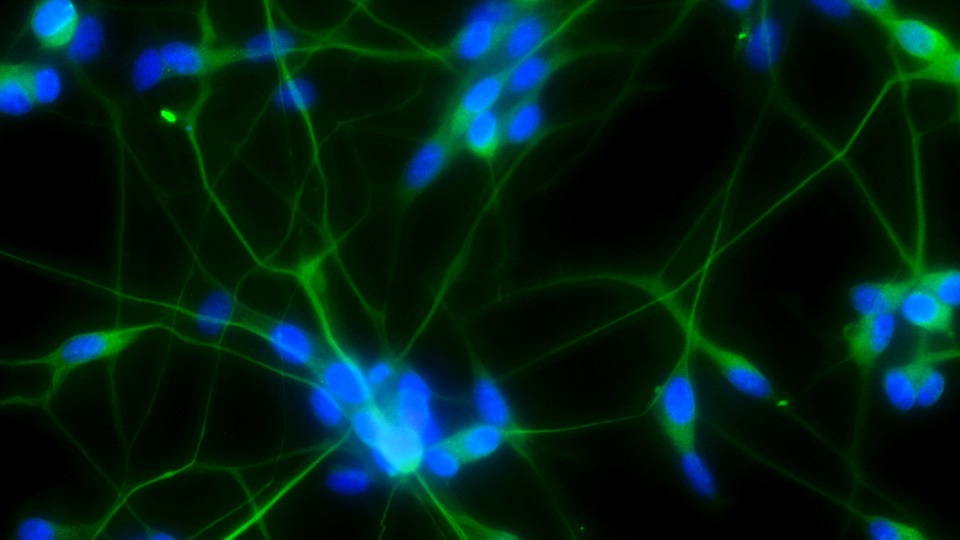 Image showing living neuronal cell circuits grown in the lab