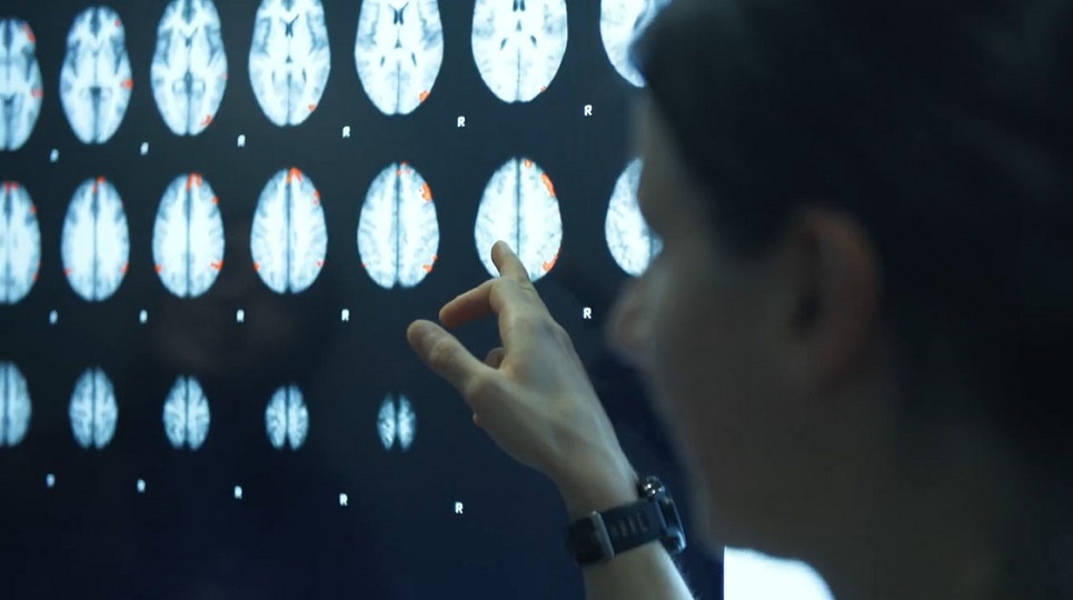 images of brain scans on a screen with an academic pointing toward it